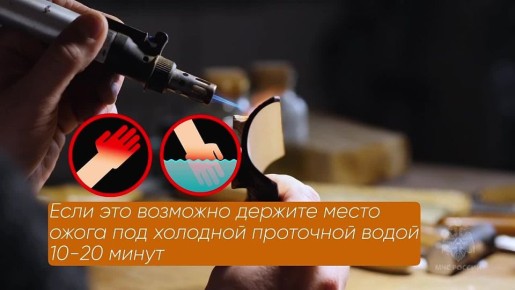 Действия при ожогах – список "можно" и "нельзя"