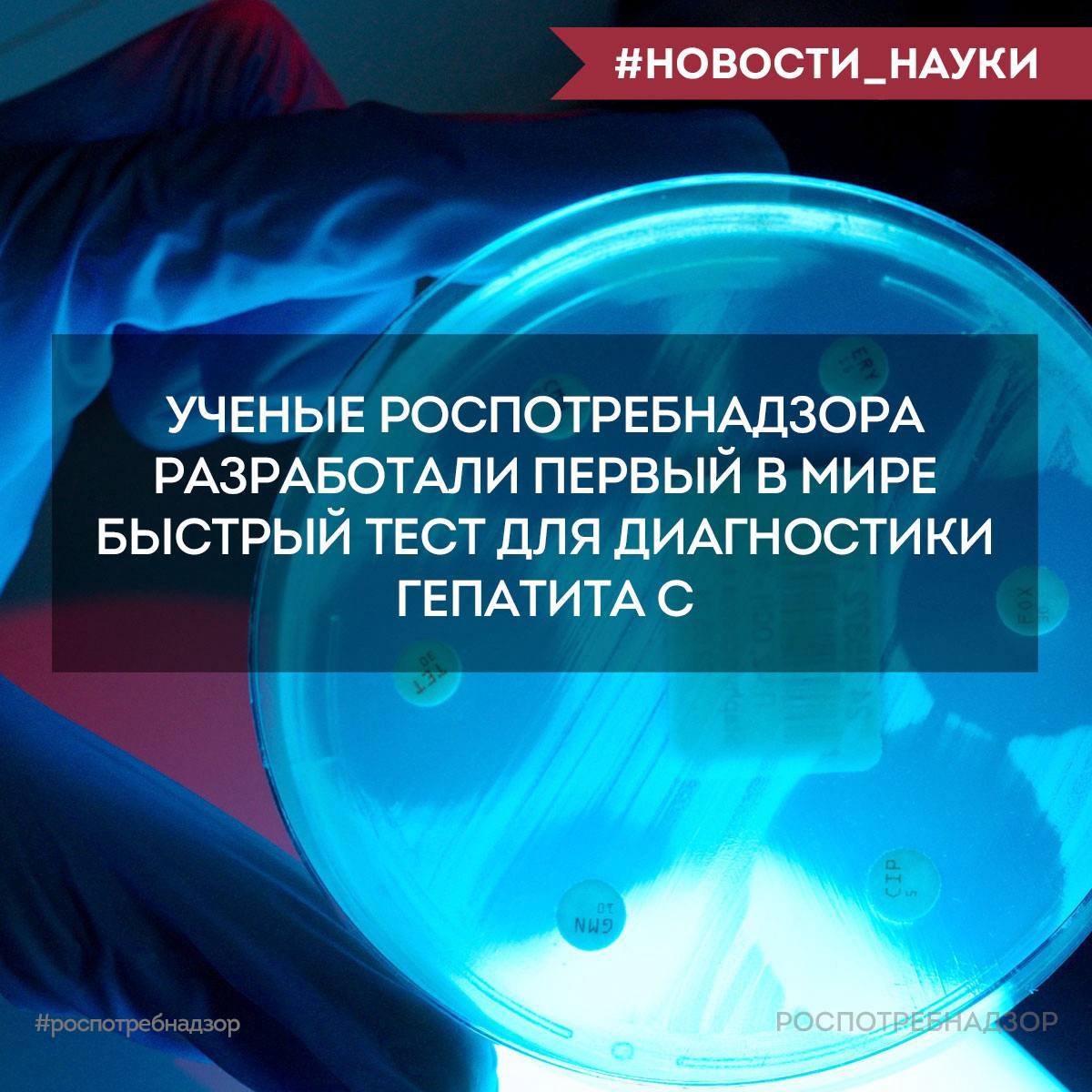 В России зарегистрирован первый в мире быстрый тест на гепатит C. ФБУН ЦНИИ эпидемиологии Роспотребнадзора зарегистрировал LAMPтест, который сокращает время диагностики до 25–30 минут вместо 1,5–2 часов.Об этом сообщили в...