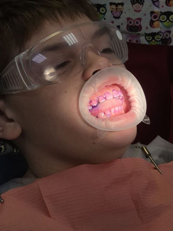 ��� ������� ���������� �������� �������� ������� ������� ���