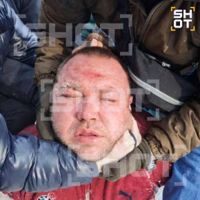 ����� ��������, �� ����� ������� ������ 9-������� �������� ���� ������ �������� � ������