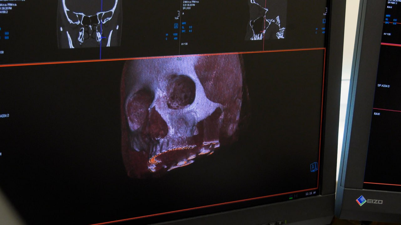 Современная диагностика без очередей и с максимальной точностью Современная диагностика без очередей и с максимальной точностью