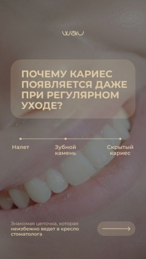 ��� ���������� �� ������� ����� � �������: ����������� ���������